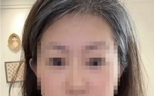 절친·남편 불륜 배신감에…하룻밤 새 '백발' 됐다는 여성