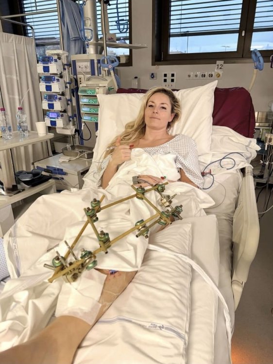 '골절 부상' 린지 본, 직접 전한 소식…"3번째 수술도 성공적"[2026 동계올림픽]