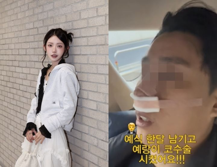 최준희, 결혼 앞두고 예비신랑 코성형…"사랑하면 닮아"